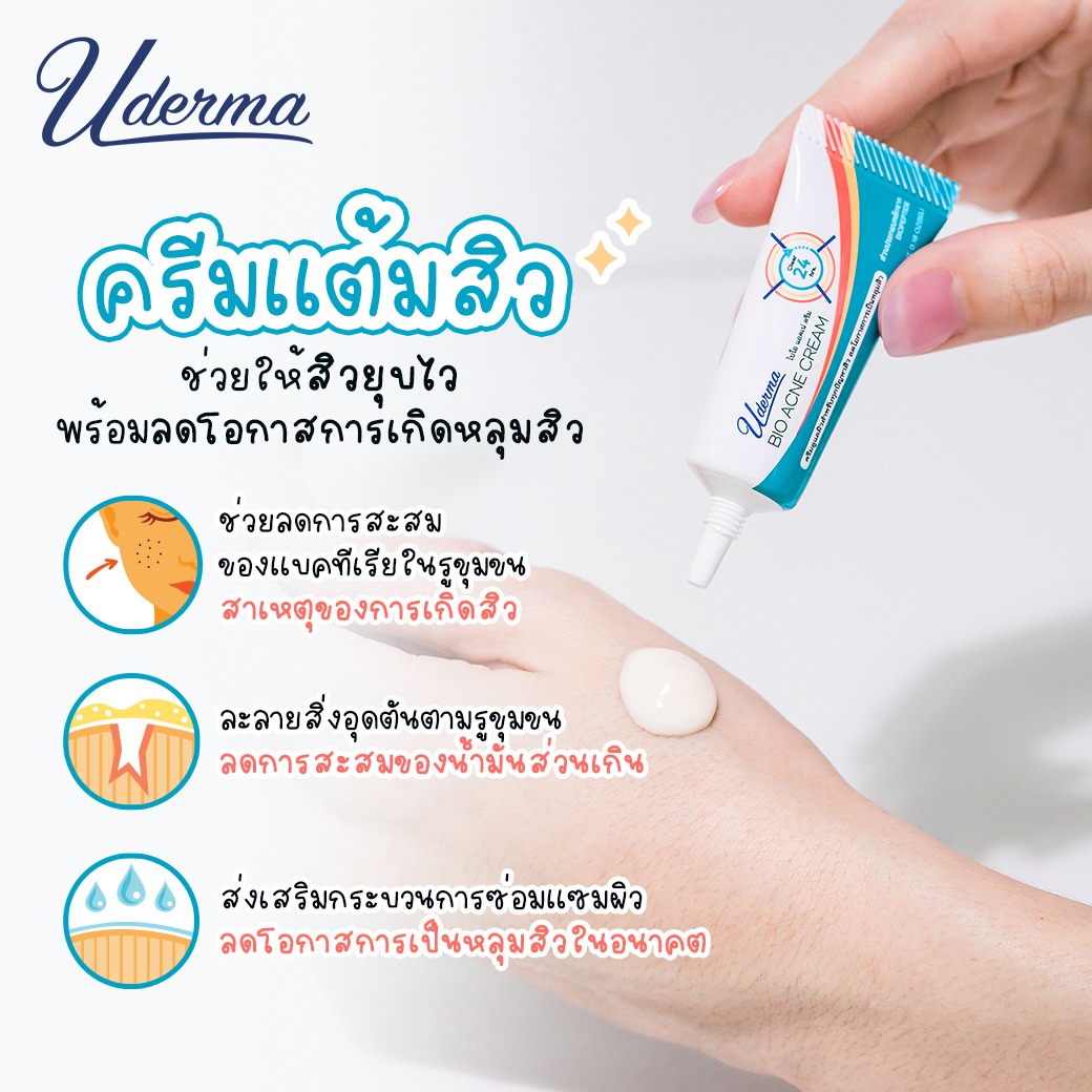 Uderma, Uderma รีวิว, Uderma ราคา, Uderma Bio Acne Cream, Uderma Bio Acne Cream รีวิว, Uderma Bio Acne Cream 5g, Uderma Bio Acne Cream 5g ครีมแต้มสิว, ครีมแต้มสิว, Uderma ครีมแต้มสิว